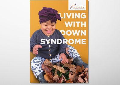 Living with Down syndrome (PDF)